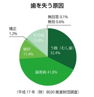 歯を失う原因